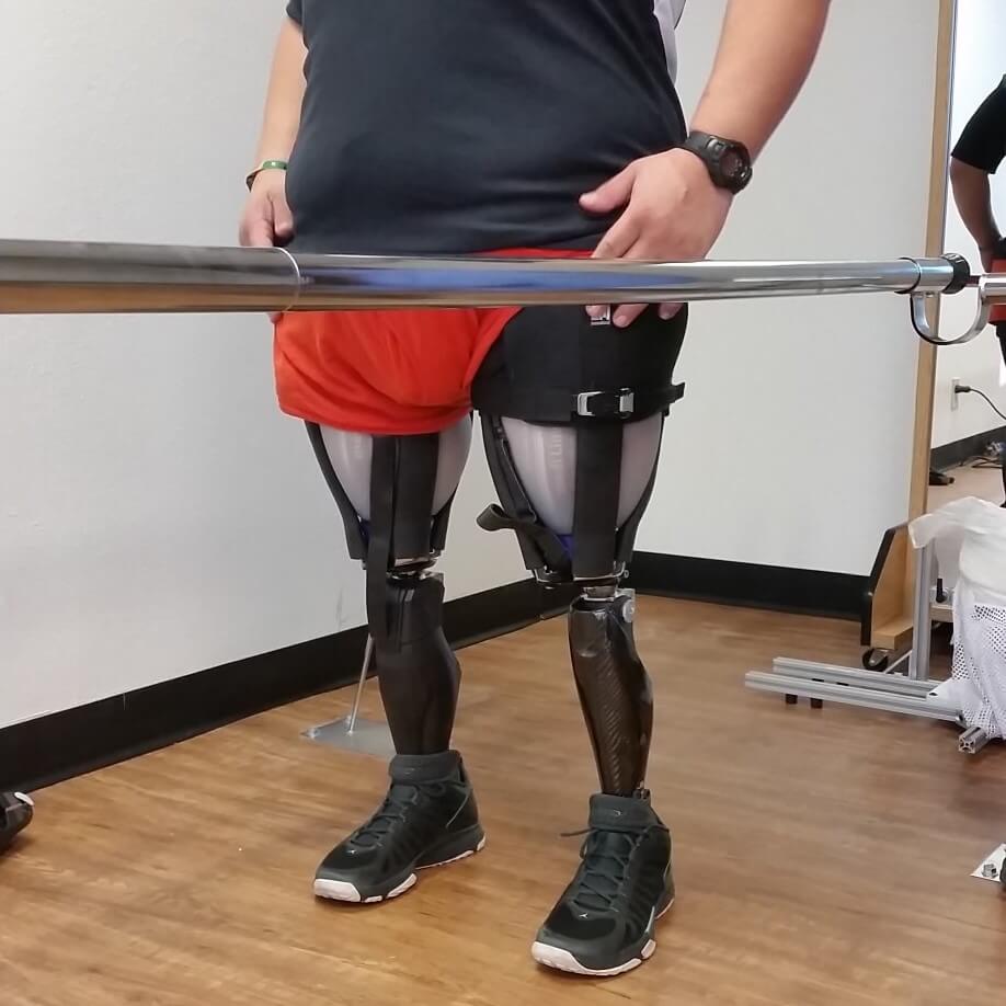 Patient standing with bilateral prostheses at parallel bars