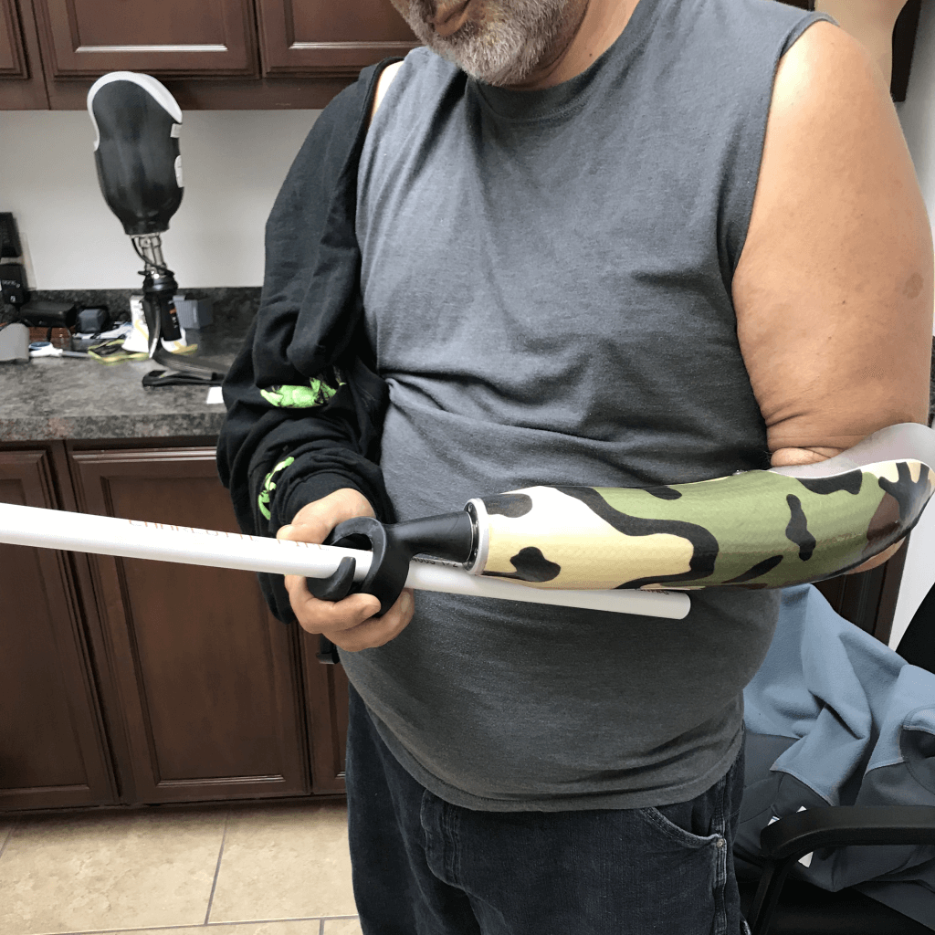 Patient using an activity-specific upper-limb prosthesis